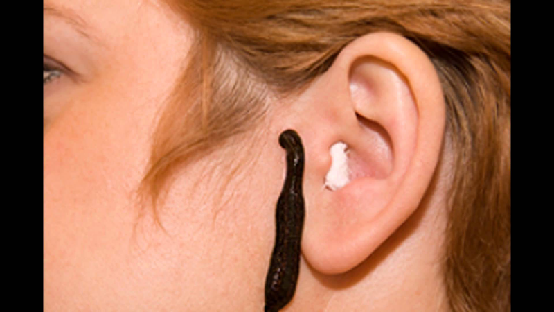 Illustration for article titled Best Leech Therapy Treatment In India